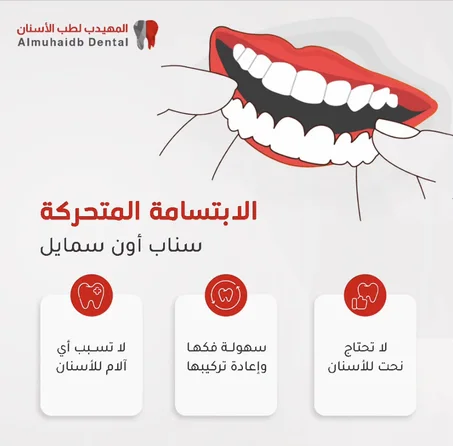 الابتسامه المتحركه