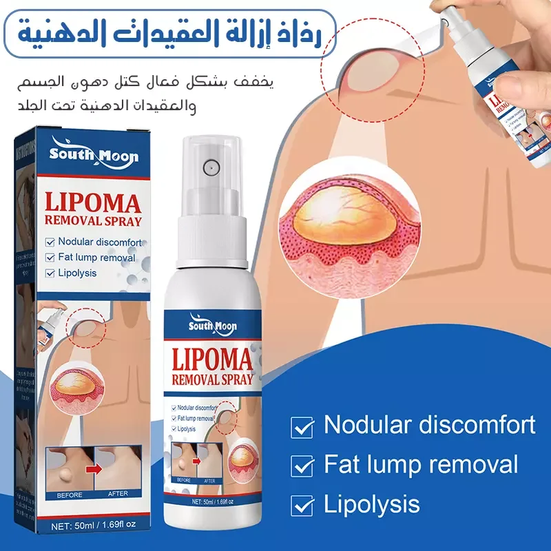 حلّ فوري للتخلّص من العقد الدهنية