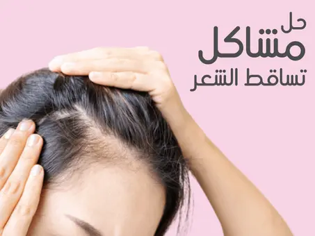 تساقط الشعر