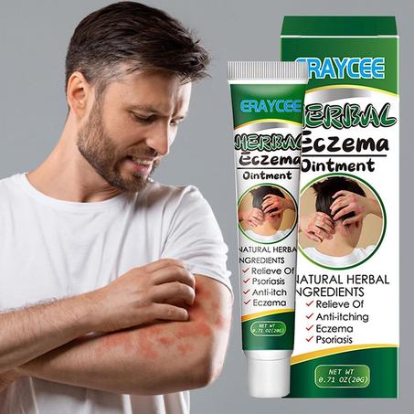 Herbal Ointment For Eczema