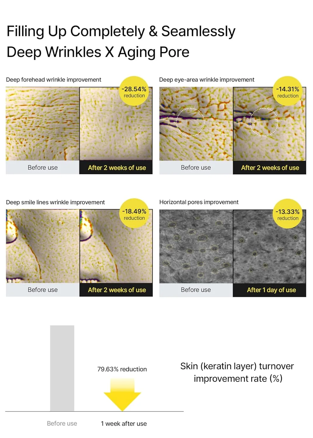 Retinal shot لعلاج التجاعيد و خيوط الابتسامة