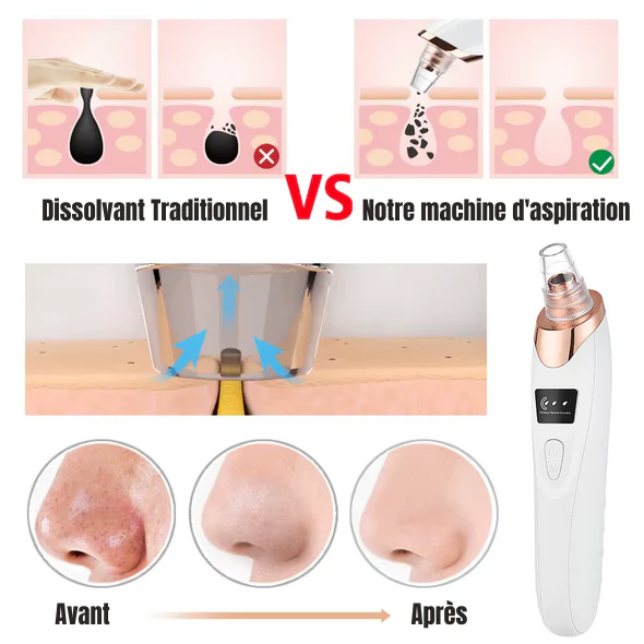 Aspirateur Électrique Pour Nettoyage et Soin Intégral