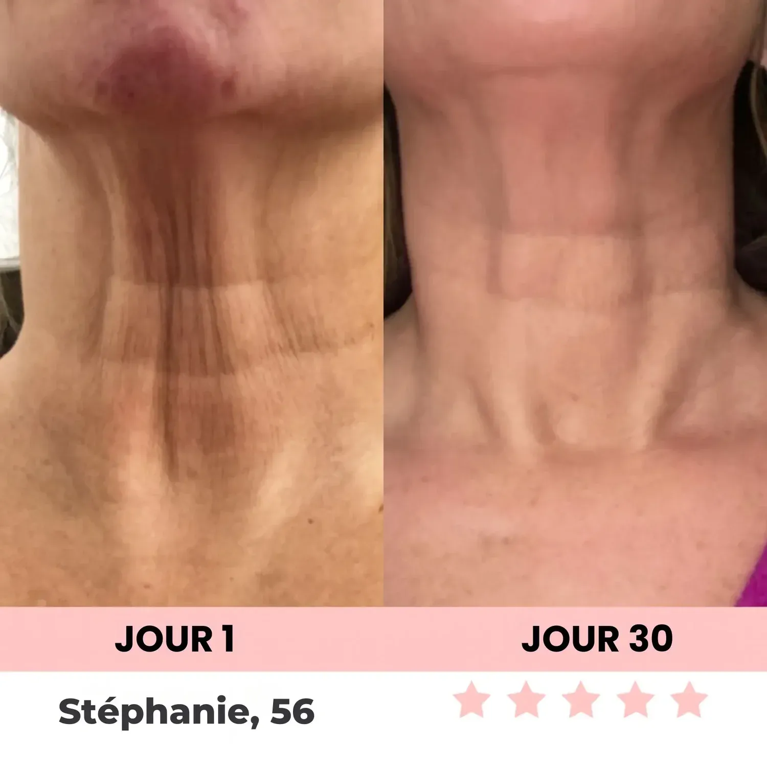 LenaSilk™ Sculpteur facial LED ✨LIVRAISON GRATUITE✨