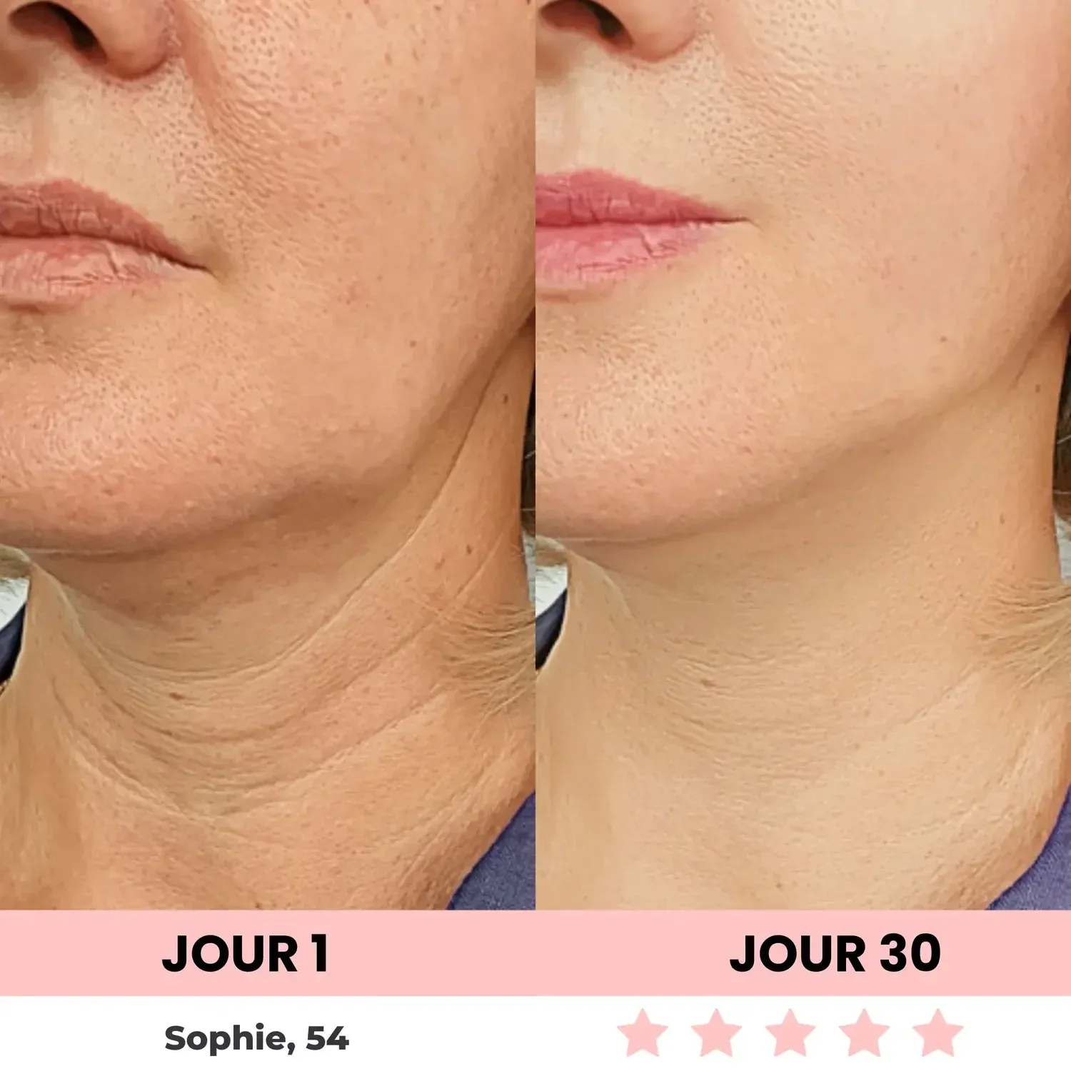 LenaSilk™ Sculpteur facial LED ✨LIVRAISON GRATUITE✨