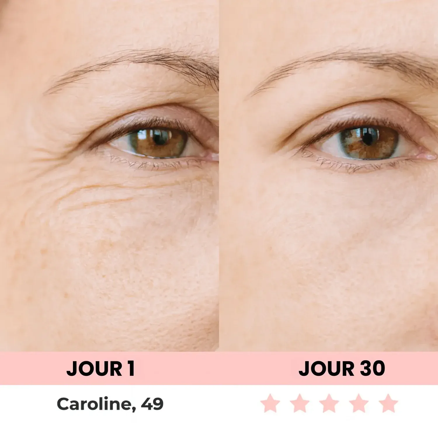 LenaSilk™ Sculpteur facial LED ✨LIVRAISON GRATUITE✨
