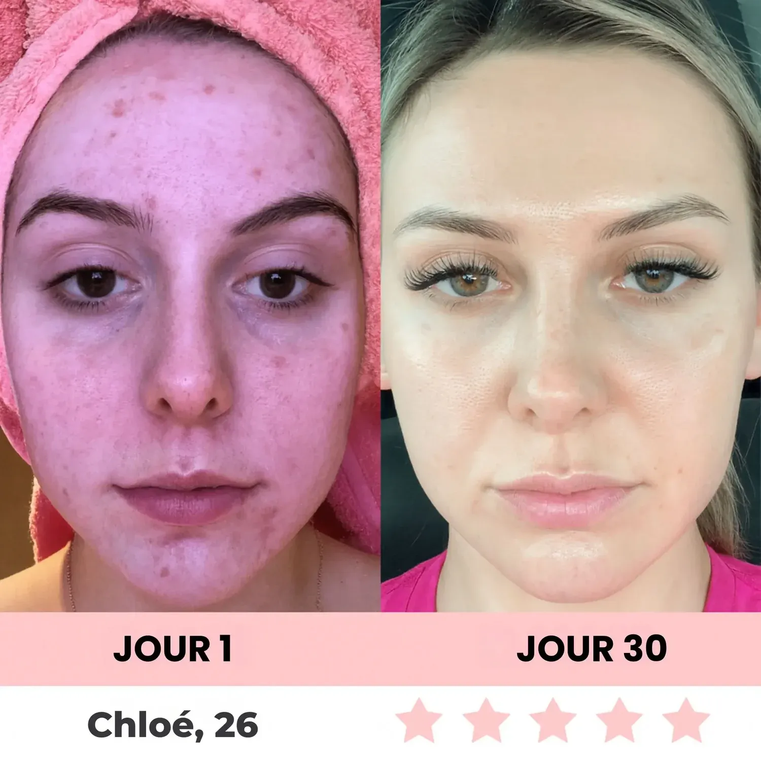 LenaSilk™ Sculpteur facial LED ✨LIVRAISON GRATUITE✨
