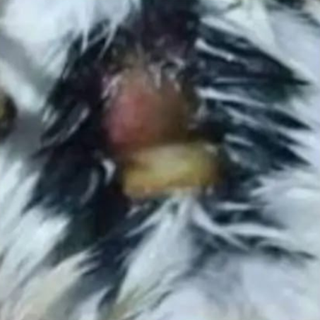 داء المبيضات (الكنديدا)Candidiasis