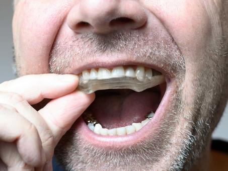 kit d'empreinte+ gouttière anti bruxisme