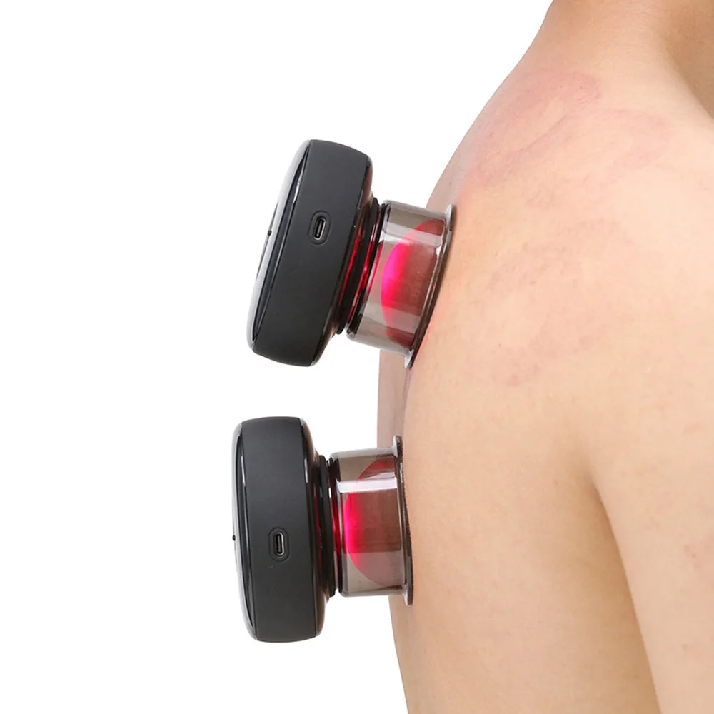 حل آمن لتخفيف آلام الظهر والرقبة في دقائق – بدون زيارة مراكز الحجامة