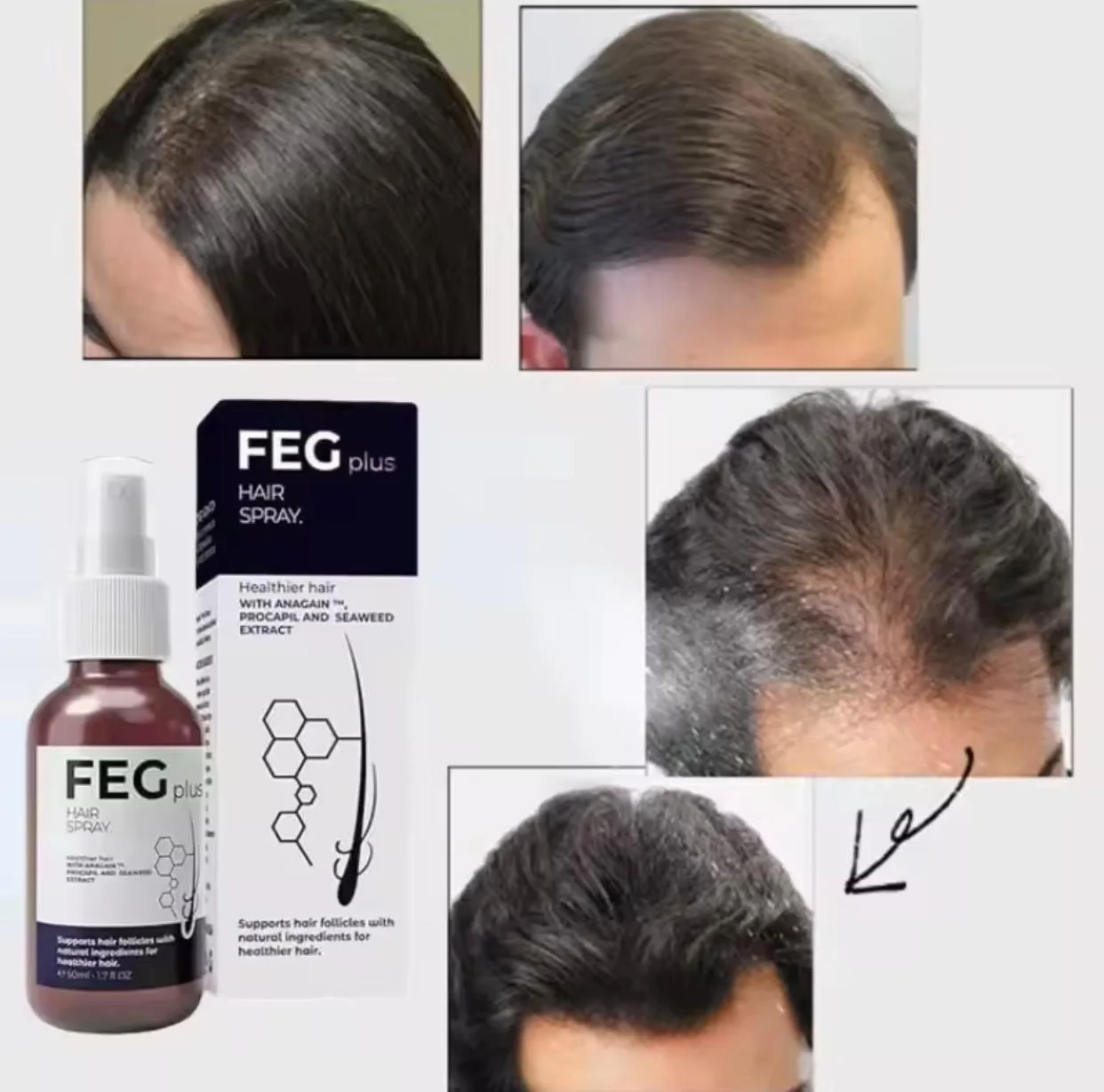 زيت FEG HAIR لتقوية الشعر وملأ الفراغات
