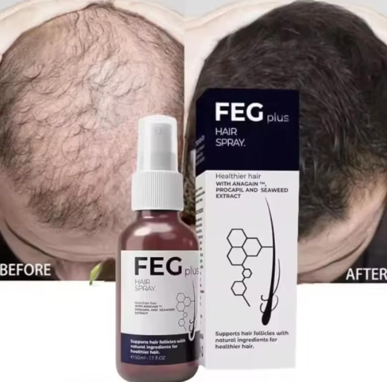 زيت FEG HAIR لتقوية الشعر وملأ الفراغات