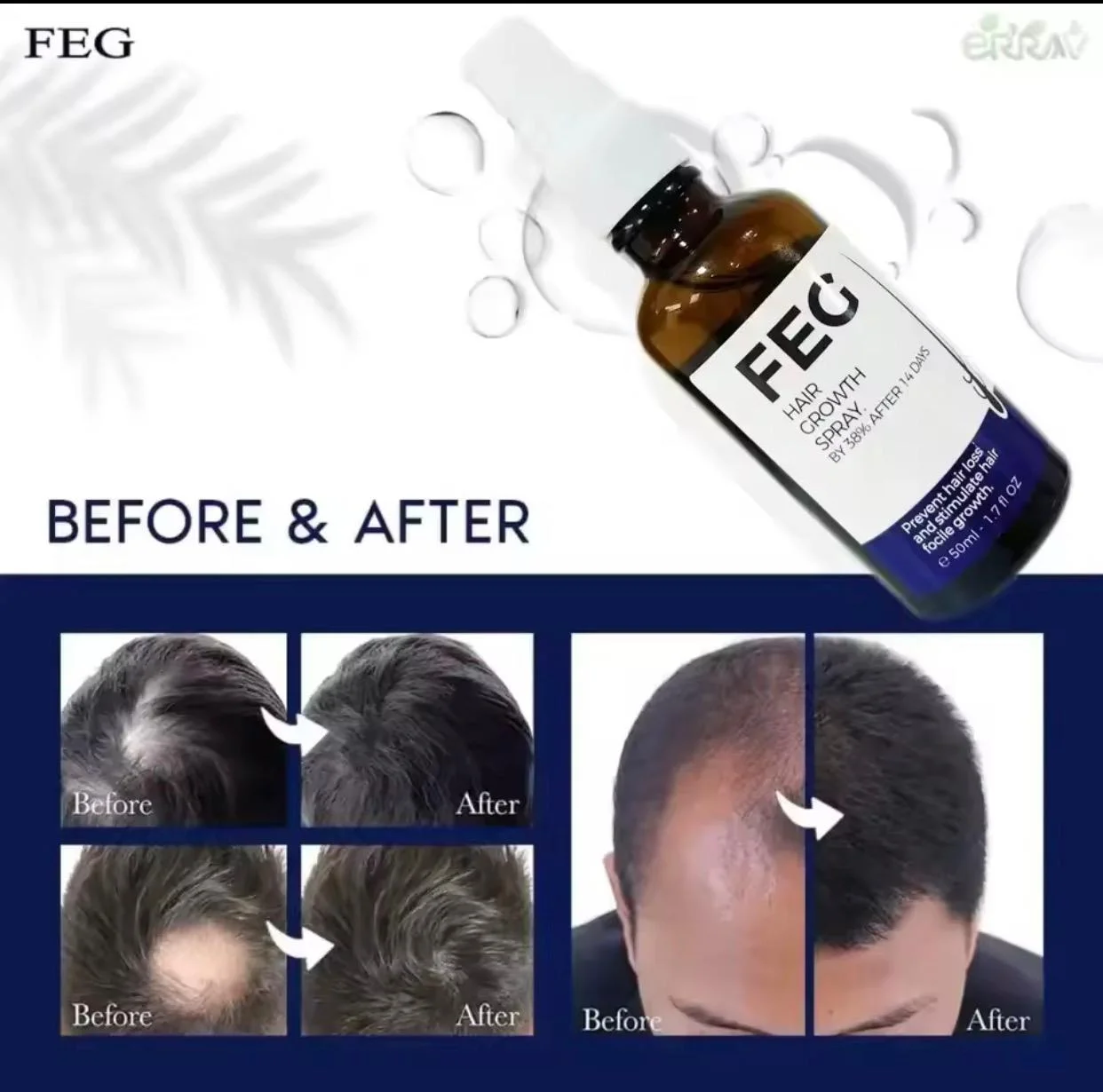 زيت FEG HAIR لتقوية الشعر وملأ الفراغات