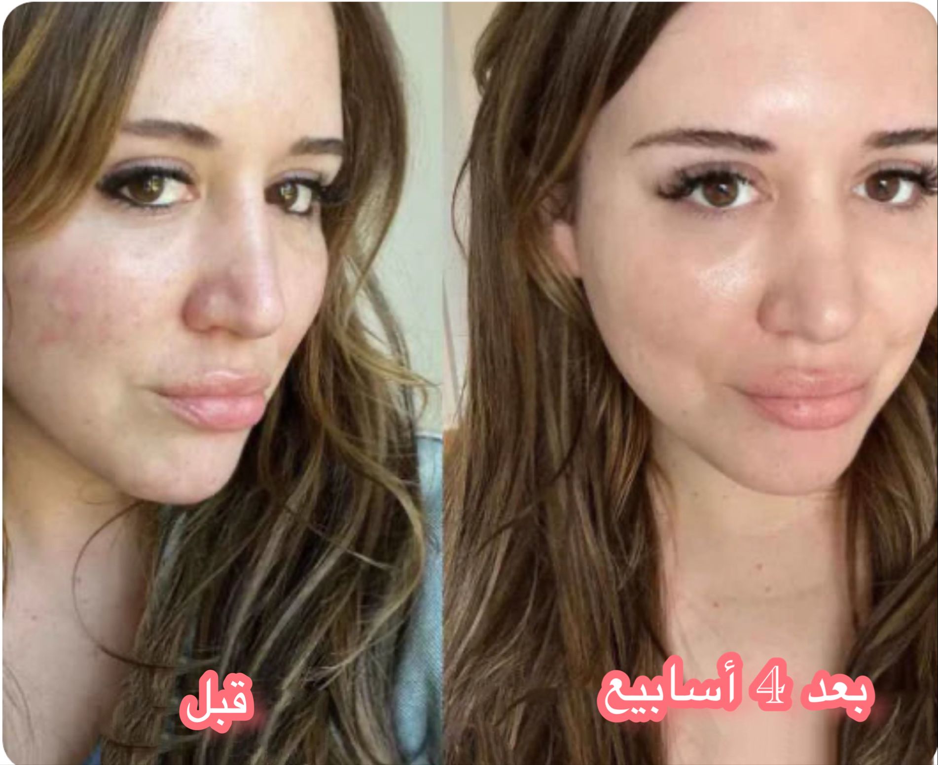 stores/2de37aabe59a91de2dfb0c5b5f9701e1/products/rg13GOgtE7zA0CPinJUcg3VEZTa8tYsdLiEKbaTo.jpg