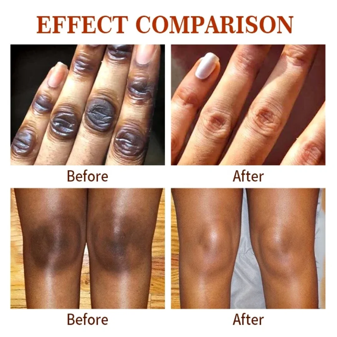 Dark Knuckle Whitening SERUM