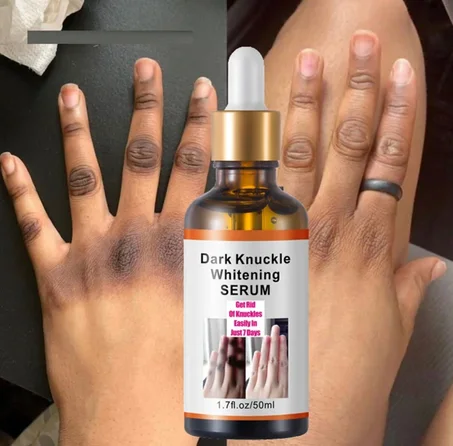 Dark Knuckle Whitening SERUM
