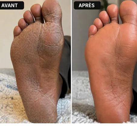 Lime électrique pour pied