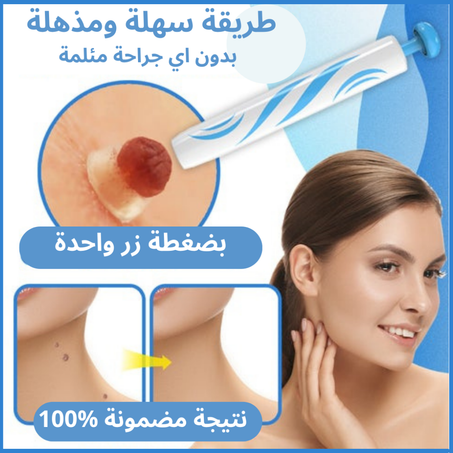 قلم ازالة الثآليل والشامات الزوائد الجلدية