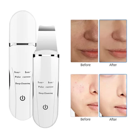 مقشر وتنظيف البشرة بالموجات فوق الصوتية