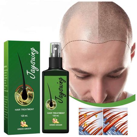 بخاخ الزنجبيل الأخضر ضد تساقط الشعر للرجال والنساء الأكثر طلباً في العالم1