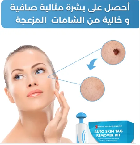 قلم ازالة الثآليل والشامات الزوائد الجلدية الأكثر مبيعا في المملكة .
