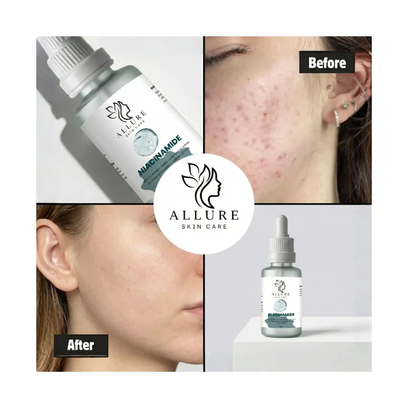 Sérum Niacinamide 10% - Allure Skin Care | 50ml