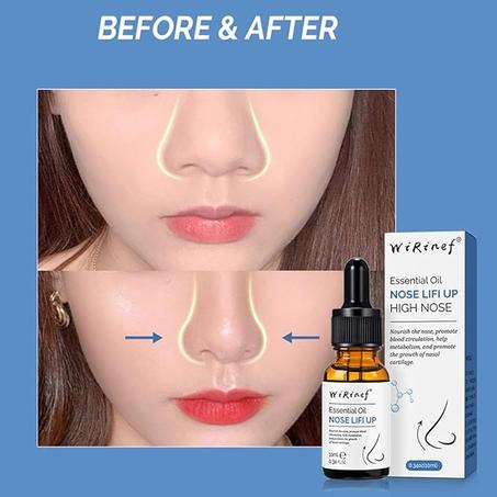 زيت تصغير الأنف الثوري الجديد (تصفية 2025)