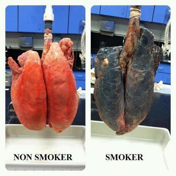 smoking
