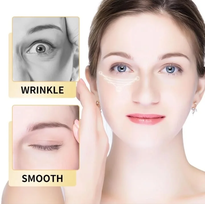 كريم الهالات السوداء