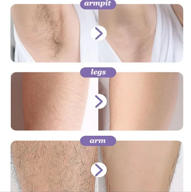 Crystal hair removal