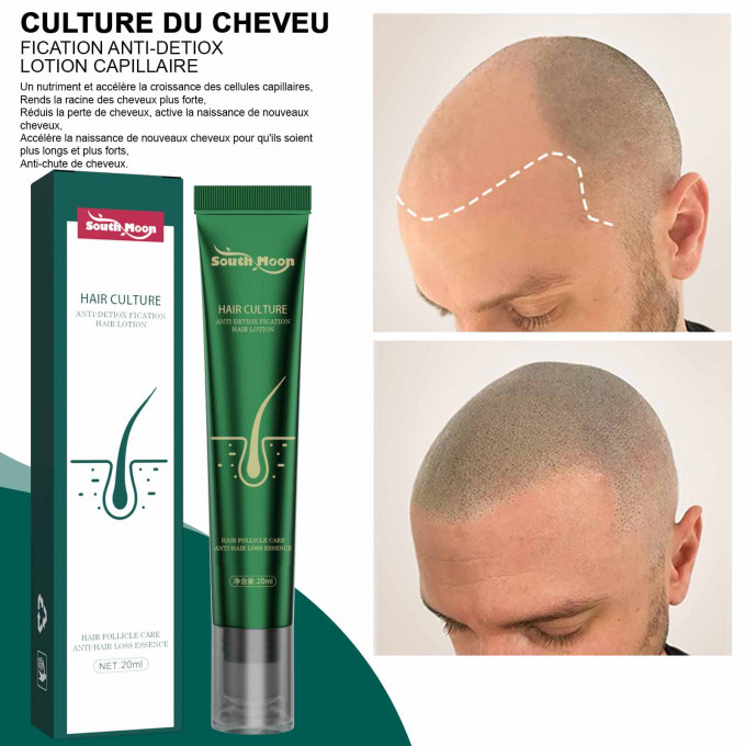 Sérum pour la repousse des cheveux, Anti-chute