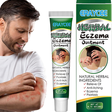 مرهم عشبي للأكزيما