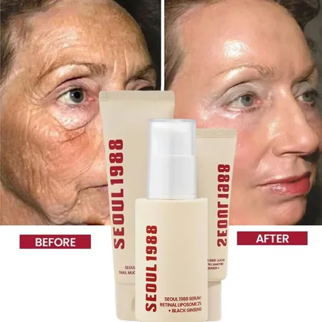 SEOUL 1988 Soin anti-rides de rétinal