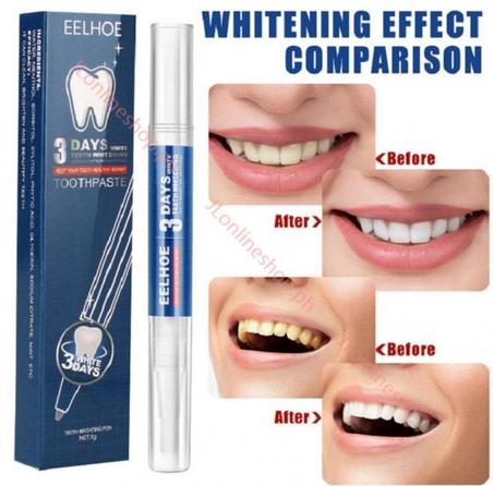 قلم تبييض الأسنان