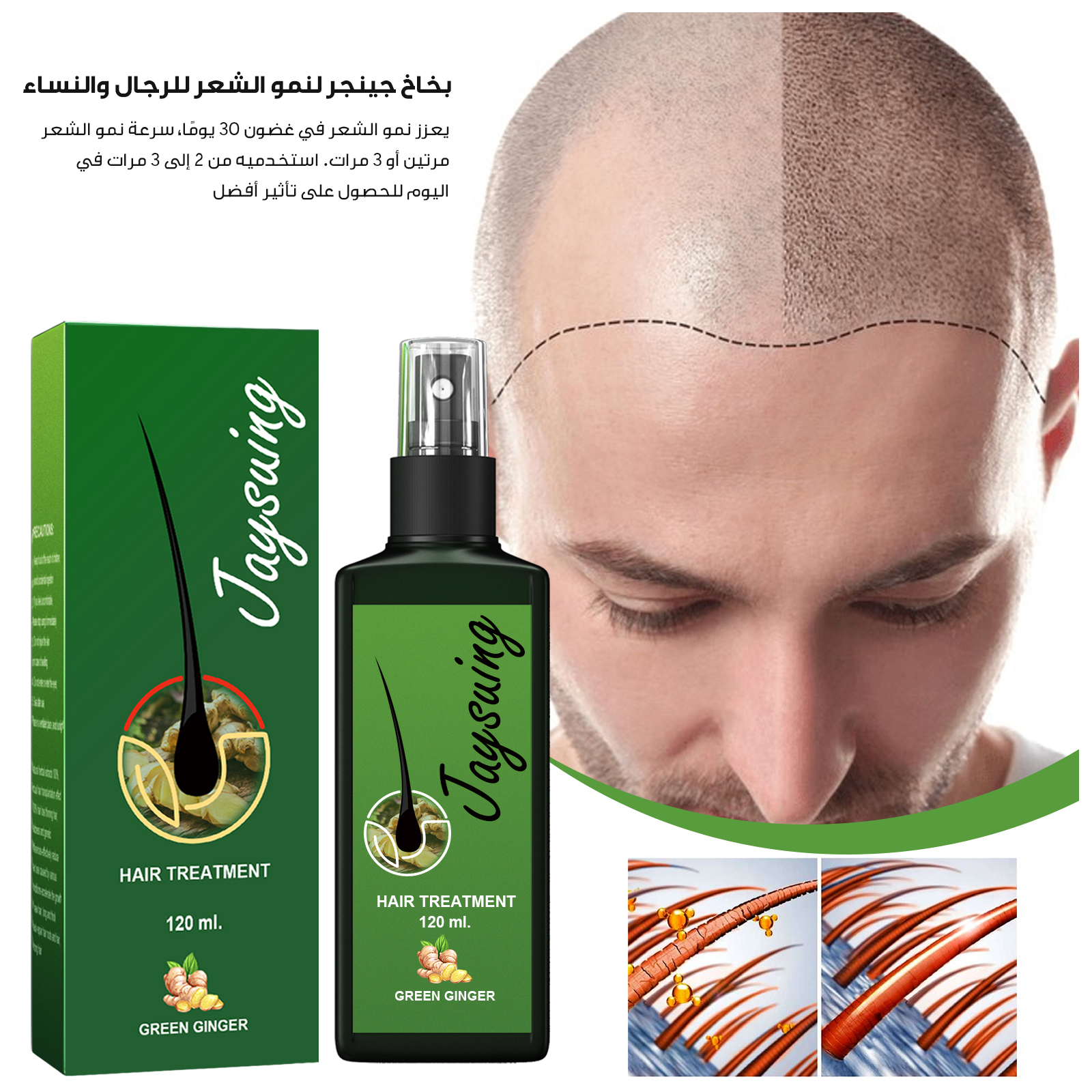 بخاخ معالجة الشعر بالزنجبيل الأخضر لنمو الشعر
