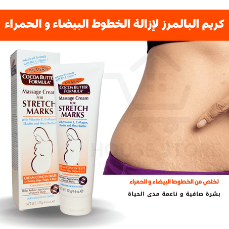 كريم البالمرز لإزالة الخطوط البيضاء و الحمراء