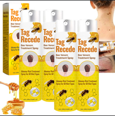 بخاخ إزالة الثآليل الطبي: الحل السريع والآمن للتخلص من الثآليل بدون ألم