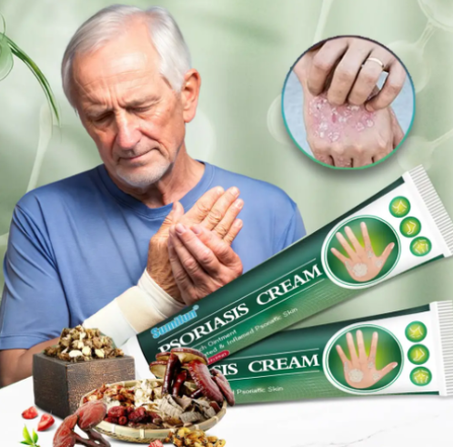 الكريم المعجزة لإزالة الصدفية و الإكزيما