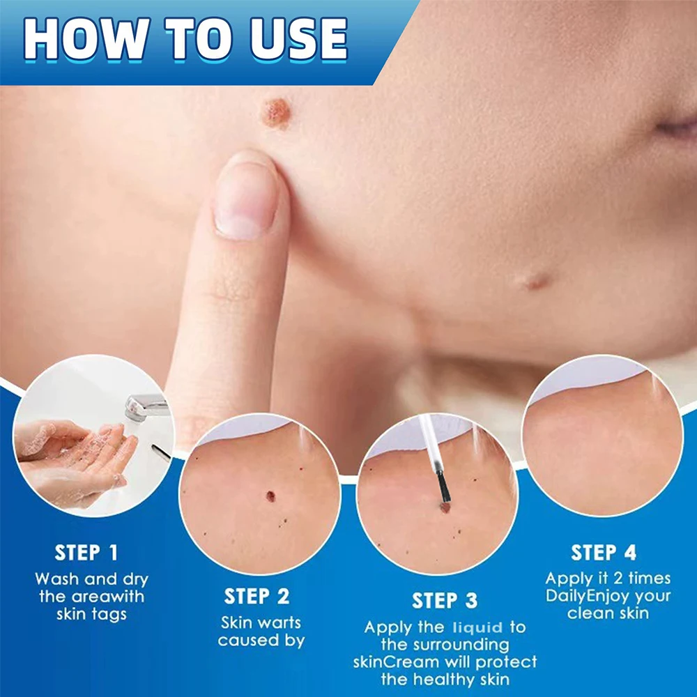 سيروم ازالة التاليل