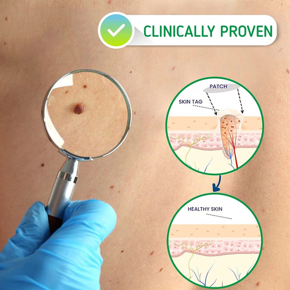 سيروم ازالة التاليل