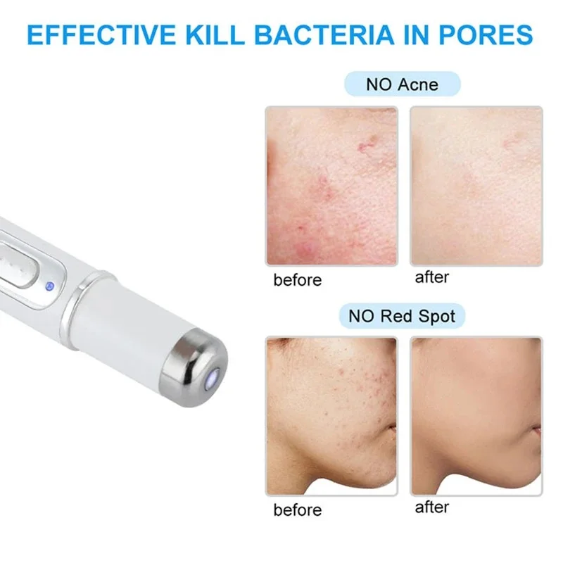 قلم الليزر للعناية بالبشرة