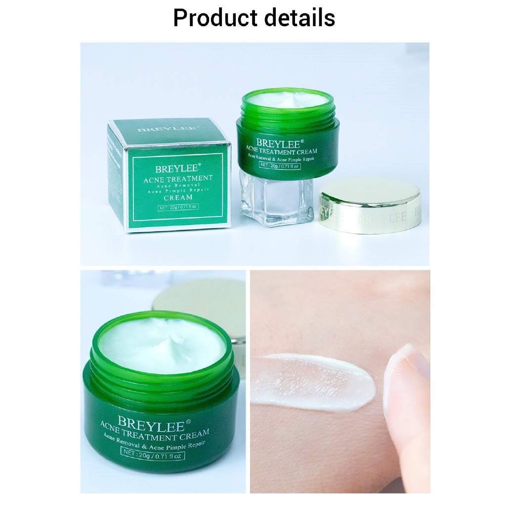 Acne Treatment Cream