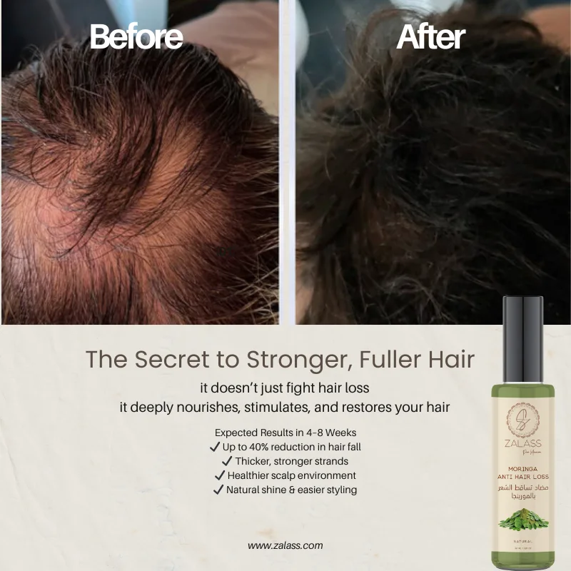 DUO MORINGA POWER – Stop Hair Loss, Start Strength