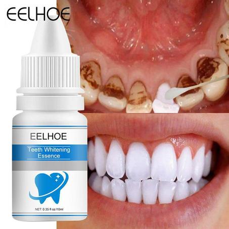 مبيض الأسنان العجيب EELHOE