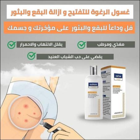 غسول الرغوة للتفتيح و ازالة البقع والبثور Cleansing Lotion
