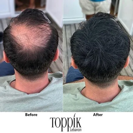 عرض عبوتين Toppik Hair Fibers لفراغات الشعر ( اللون اسود )