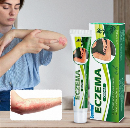 كريم الإغزيمة والصدفية