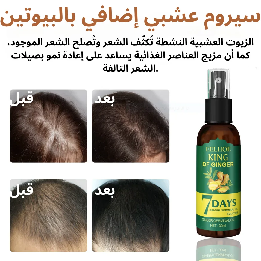 سيروم الزنجبيل لنمو الشعر