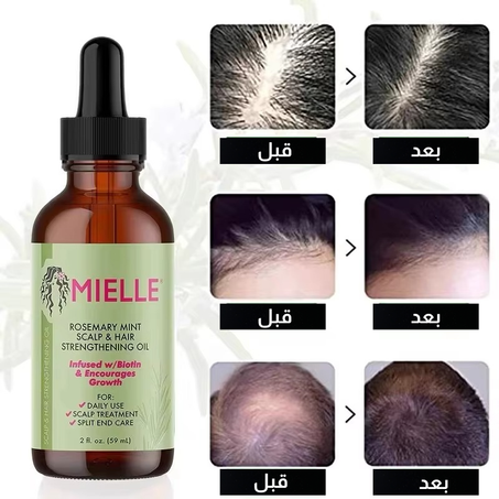 زيت الروزماري بالنعناع – لتكثيف الشعر ولمعانه الطبيعي