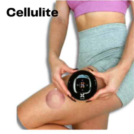 Body Sculpting & Cellulite Solution Kit