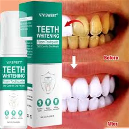 Mousse de blanchiment des dents stop Mauvaise haleine